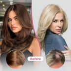 Real Human Hair Topper10 inch Women for Thinning Hair Swiss Base  Hairpiece